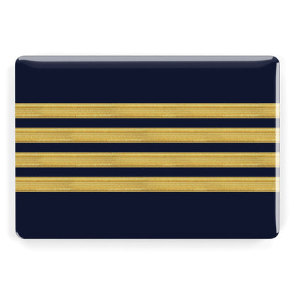 Navy and Gold Pilot Stripes Apple MacBook Case