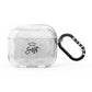 Personalised Anniversary Monochrome AirPods Glitter Case 3rd Gen