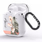 Personalised Anthurium AirPods Clear Case Side Image