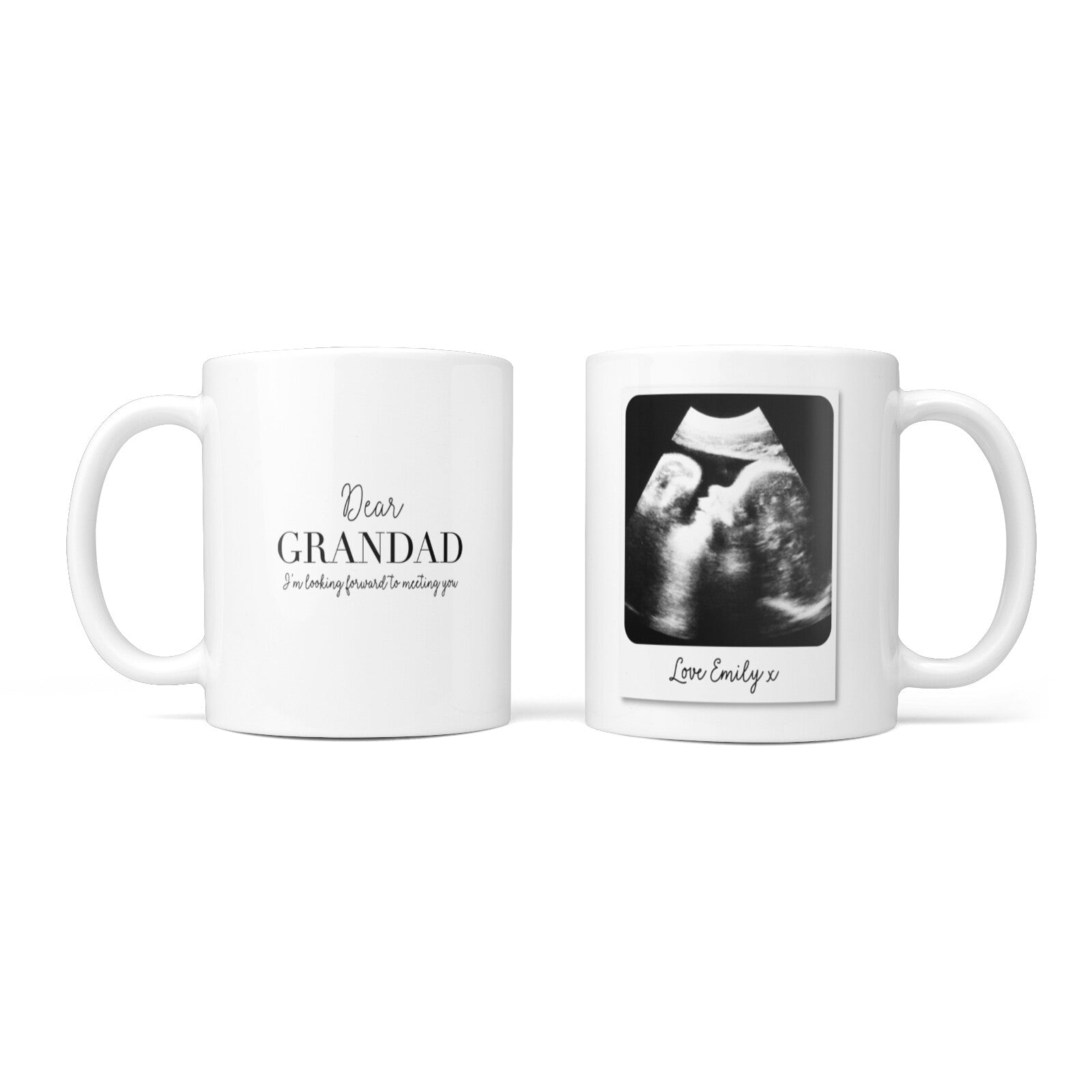 Personalised Baby Scan Photo Upload 10oz Mug Alternative Image 3