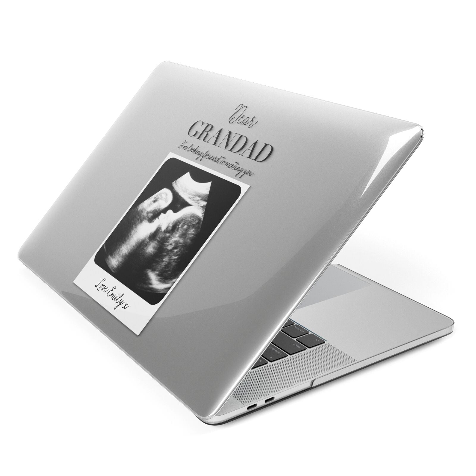 Personalised Baby Scan Photo Upload Apple MacBook Case Side View