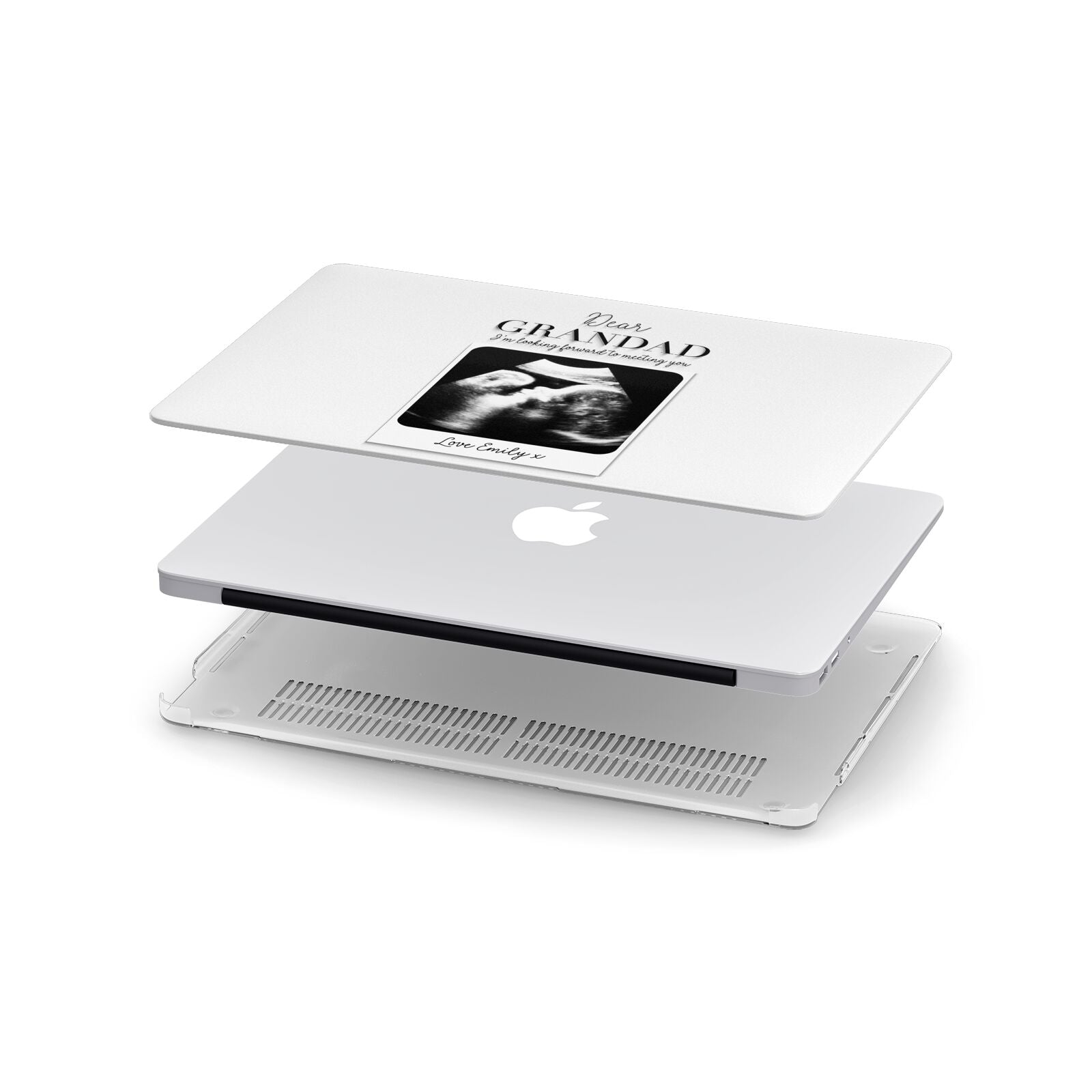 Personalised Baby Scan Photo Upload Apple MacBook Case in Detail