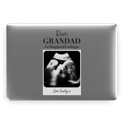 Personalised Baby Scan Photo Upload Apple MacBook Case