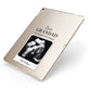 Personalised Baby Scan Photo Upload Apple iPad Case on Gold iPad Side View
