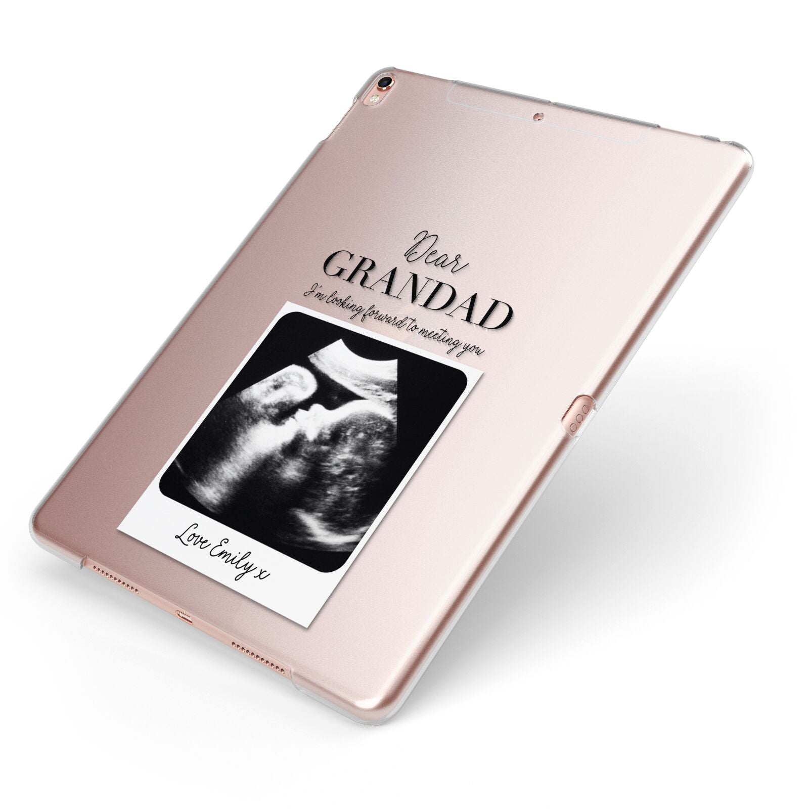 Personalised Baby Scan Photo Upload Apple iPad Case on Rose Gold iPad Side View