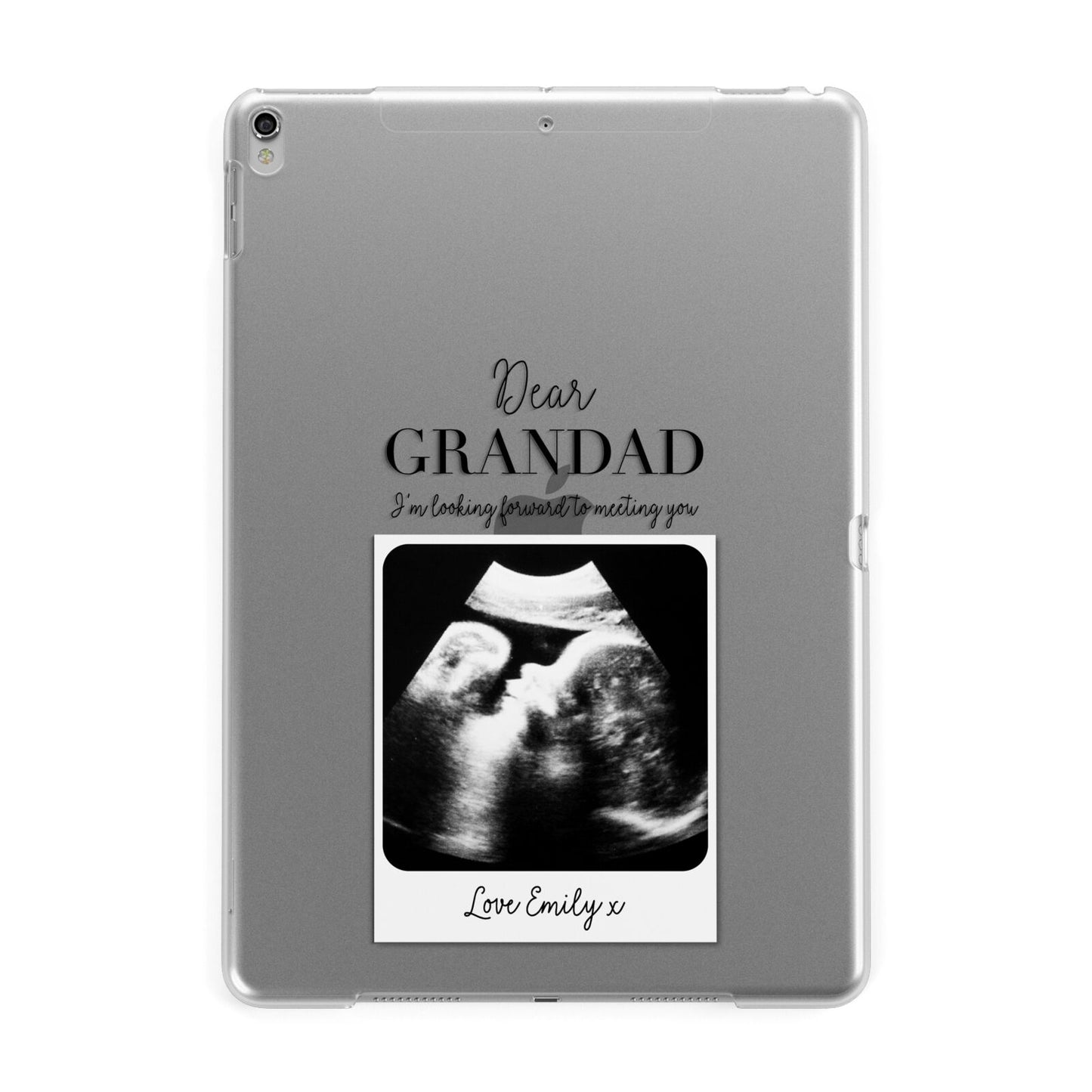 Personalised Baby Scan Photo Upload Apple iPad Silver Case