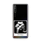 Personalised Baby Scan Photo Upload Huawei Enjoy 10s Phone Case