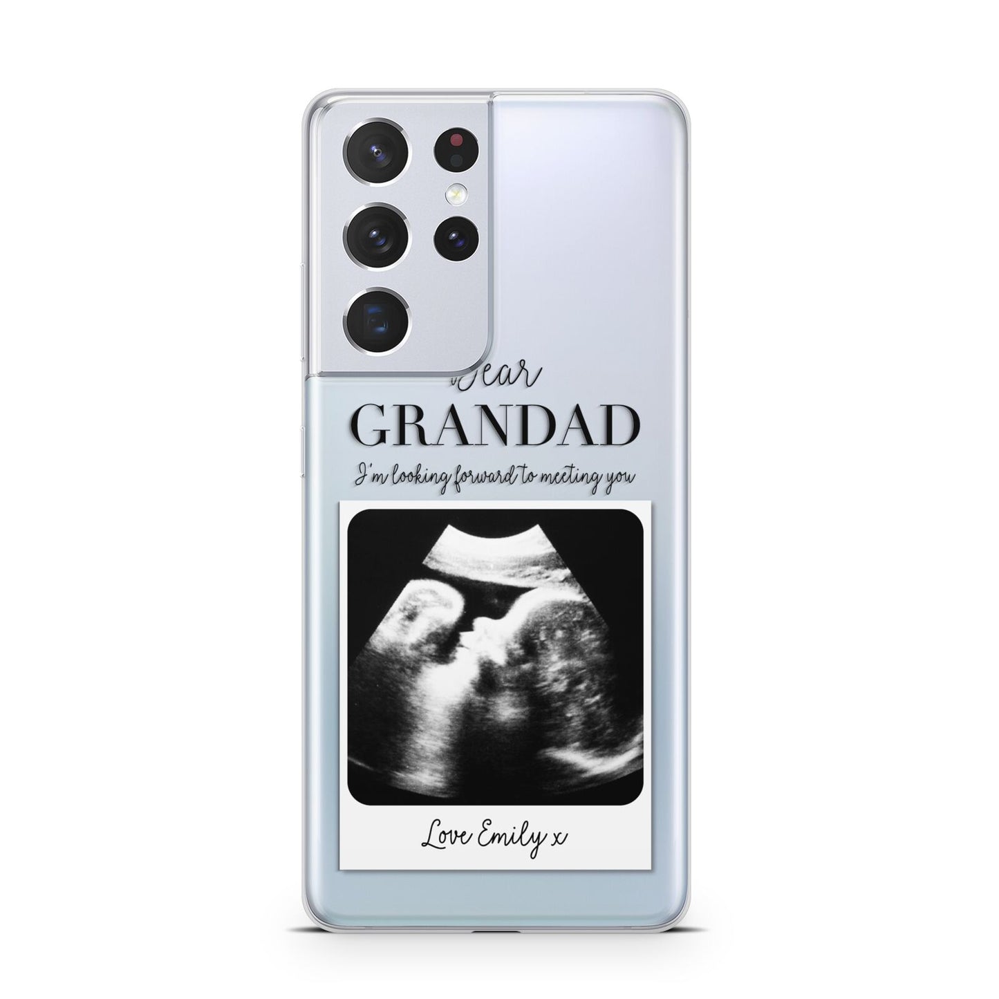Personalised Baby Scan Photo Upload Samsung S21 Ultra Case