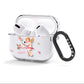 Personalised Cherub AirPods Clear Case 3rd Gen Side Image