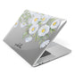 Personalised Daisy Flower Apple MacBook Case Side View