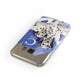 Personalised Dalmatian Samsung Galaxy Case Front Close Up