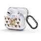 Personalised Dog Photo AirPods Glitter Case 3rd Gen Side Image