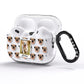 Personalised Dog Photo AirPods Pro Glitter Case Side Image