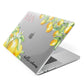 Personalised Initials Lemons Apple MacBook Case Side View