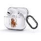 Personalised Labradoodle AirPods Glitter Case 3rd Gen Side Image
