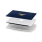 Personalised Pilot Wings Apple MacBook Case in Detail