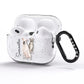 Personalised Staffordshire Dog AirPods Pro Glitter Case Side Image