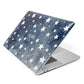 Personalised Star Print Apple MacBook Case Side View
