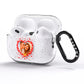 Photo Confetti Heart AirPods Pro Glitter Case Side Image