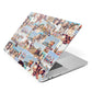 Photo Montage Apple MacBook Case Side View