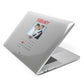 Photo Wedding Anniversary Apple MacBook Case Side View