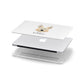 Picardy Sheepdog Personalised Apple MacBook Case in Detail
