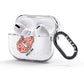 Pink Pigs Couple AirPods Glitter Case 3rd Gen Side Image