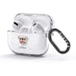Pug Personalised AirPods Glitter Case 3rd Gen Side Image