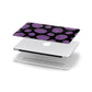 Purple Brains Apple MacBook Case in Detail