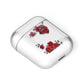 Red Roses AirPods Case Laid Flat