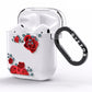 Red Roses AirPods Clear Case Side Image
