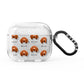 Redbone Coonhound Icon with Name AirPods Glitter Case 3rd Gen