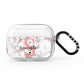 Rose Gold Personalised Marble Glitter Initial Name AirPods Pro Clear Case