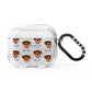 Rottweiler Icon with Name AirPods Glitter Case 3rd Gen