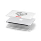 Runway Love Heart Apple MacBook Case in Detail