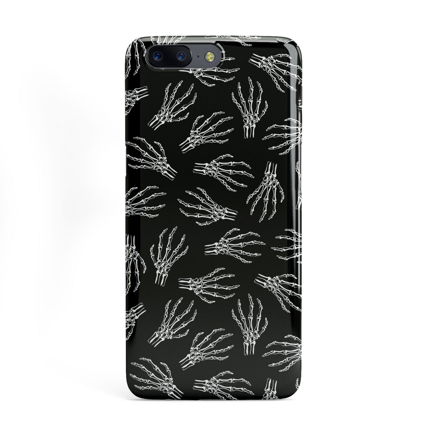 Skeleton Hands OnePlus Case