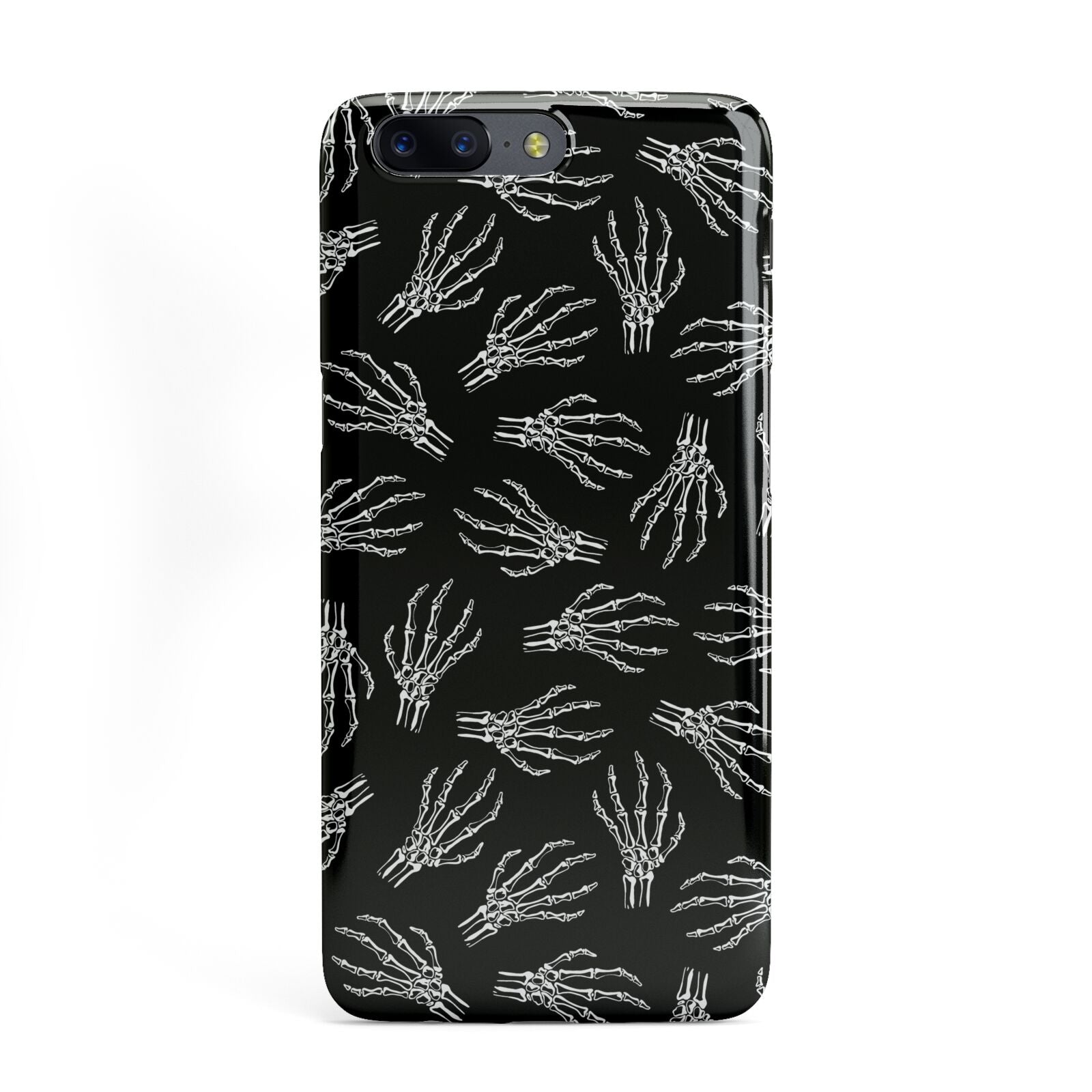 Skeleton Hands OnePlus Case