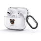 Staffordshire Bull Terrier Personalised AirPods Glitter Case 3rd Gen Side Image