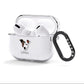 Staffy Jack Personalised AirPods Clear Case 3rd Gen Side Image