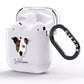 Staffy Jack Personalised AirPods Clear Case Side Image