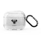 Turkish Kangal Dog Personalised AirPods Glitter Case 3rd Gen