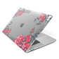 Valentine Floral Apple MacBook Case Side View