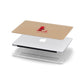 Valentine Monogram Apple MacBook Case in Detail