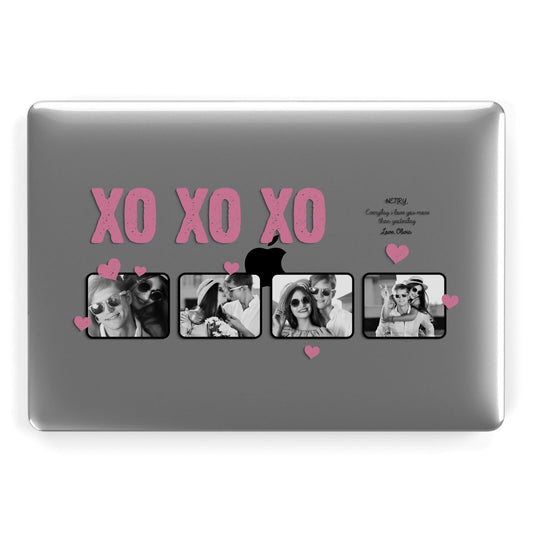 Valentines Day Photo Collage Apple MacBook Case