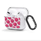 Valentines Roses AirPods Clear Case 3rd Gen Side Image