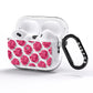 Valentines Roses AirPods Pro Glitter Case Side Image