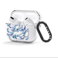 Whale AirPods Clear Case 3rd Gen Side Image