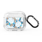 White Peonies AirPods Glitter Case 3rd Gen