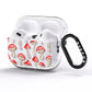 Wild Mushrooms AirPods Pro Glitter Case Side Image
